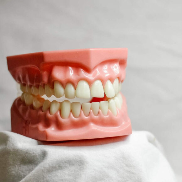 Periodoncia