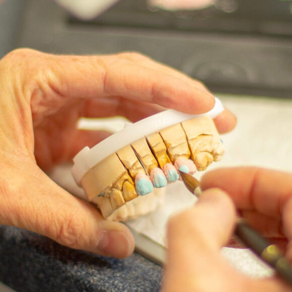 Rehabilitación Oral