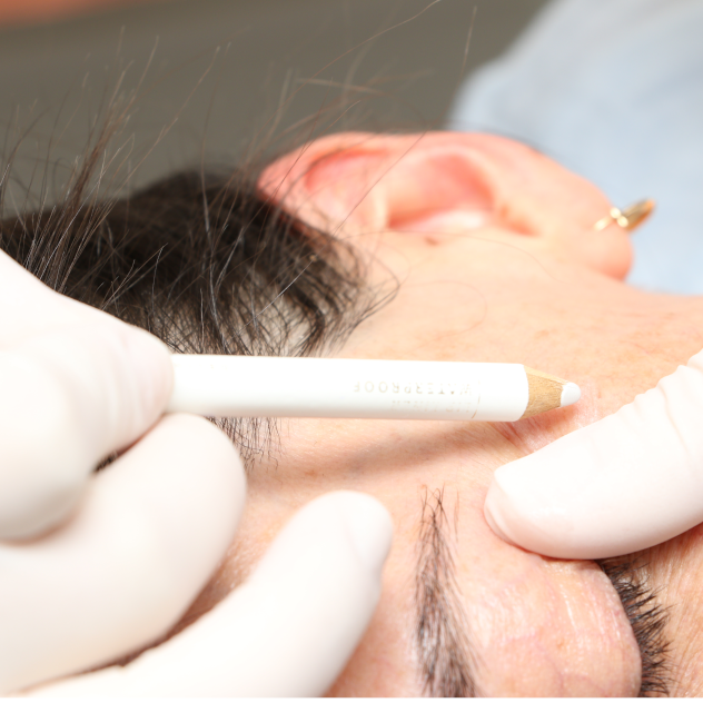 Estética Facial