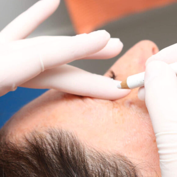 Estética Facial