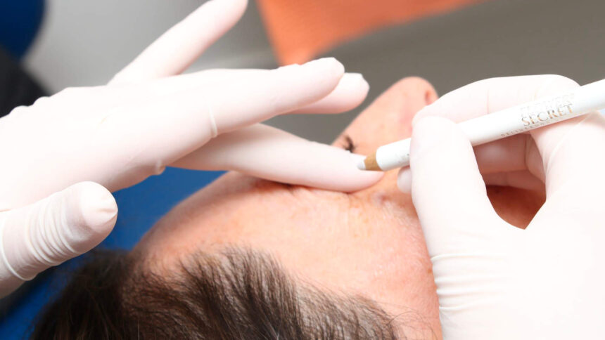Estética Facial